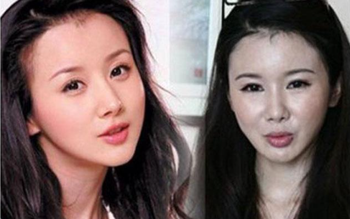 整容|盘点娱乐圈整容失败的女明星，有的整的像僵尸，最后一个可惜了