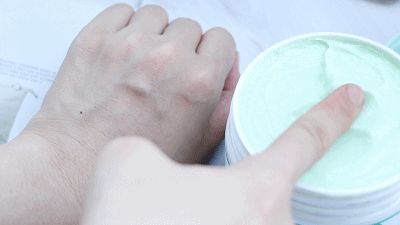 黑头|闭口、黑头、痘痘、脂肪粒……终于分清它们是什么了