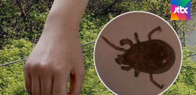 杨紫|为少女时代的Tiffany解惑：什么是恙虫病？Sunny是怎么知道的？