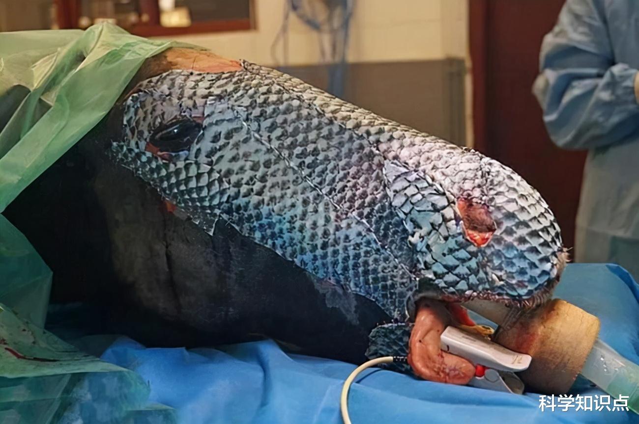 卓越|口碑逆转的入侵生物?不算好吃的罗非鱼,在烧伤领域却有卓越表现