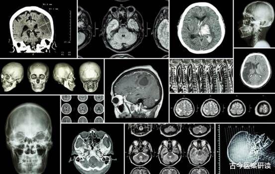 失眠|血脂“分解器”被扒出，吃一口相当8斤芹菜，医生：敞开吃，脑梗远离你
