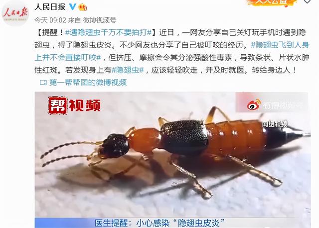 隱翅蟲|熱搜第一！醫生緊急提醒