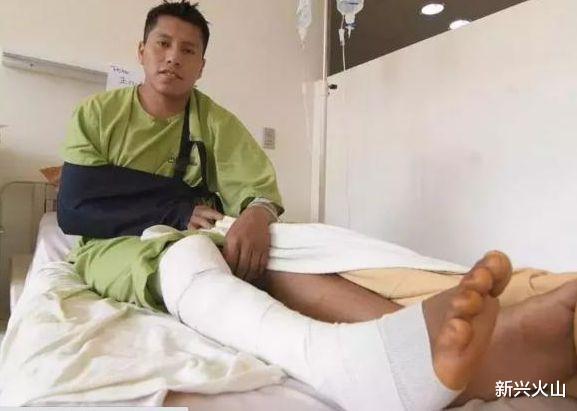 新兴火山 巴西男子两次大难不死，飞机坠毁时活下来，又从严重车祸中生还