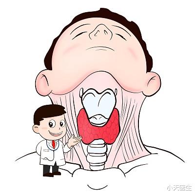 甲状腺结节|甲状腺结节发病率高，经常检查甲状腺，预防甲状腺癌做好这几步!
