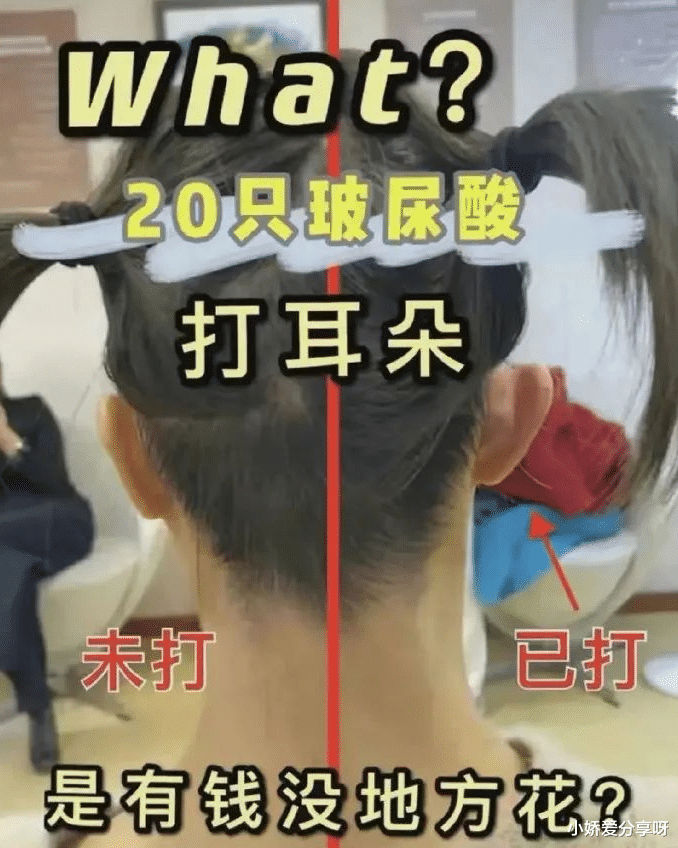 刘海|割阴、挑筋、断骨、割胃，那些为了美不要命的女人到底有多可怕