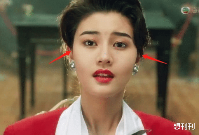 后遗症|做了颧骨内推的明星真的变美了吗?推平容易后悔难,后遗症一大堆