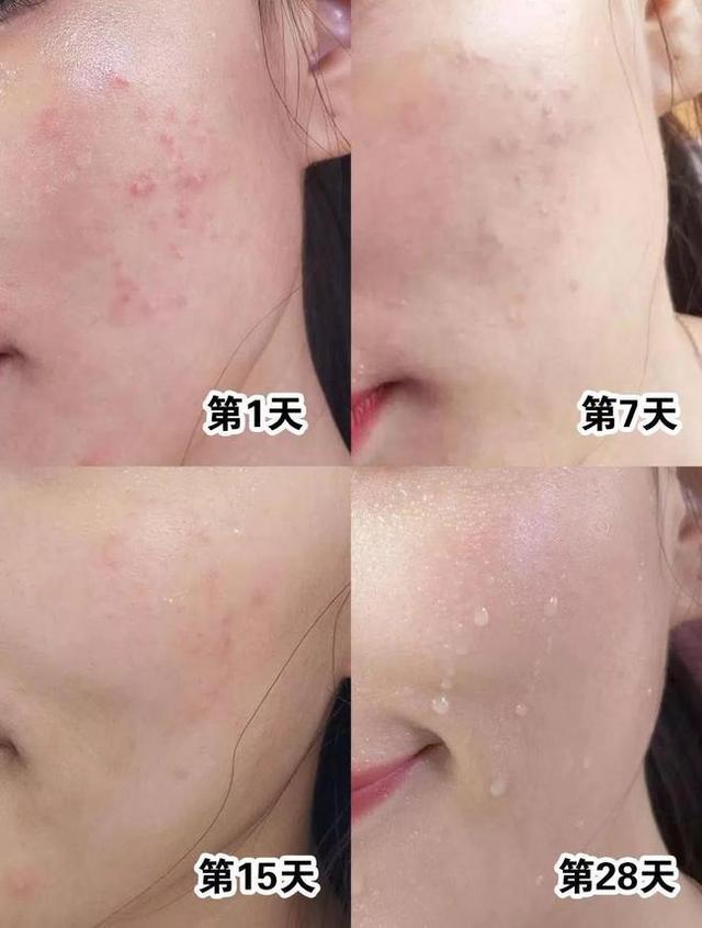 洗面奶 赵露思为了美再次“破费”了,自用洗面奶走红,网友:难怪皮肤好