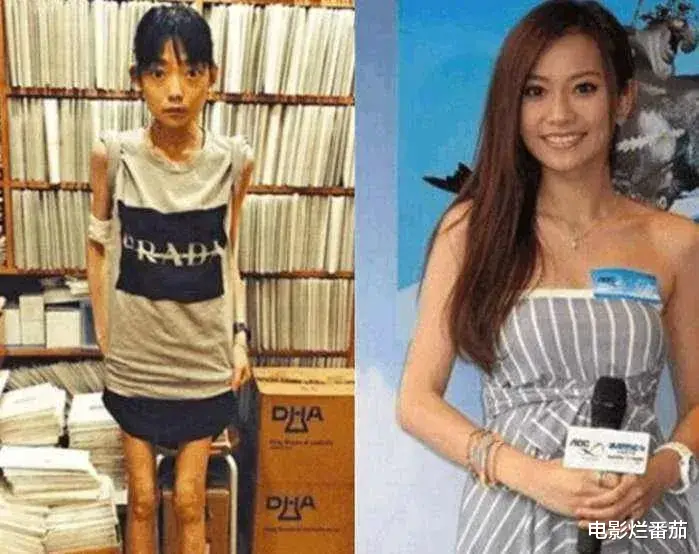 林瑞阳|“内卷”下暴瘦的娱乐圈明星,有的瘦到74斤,有的体力不支坐轮椅