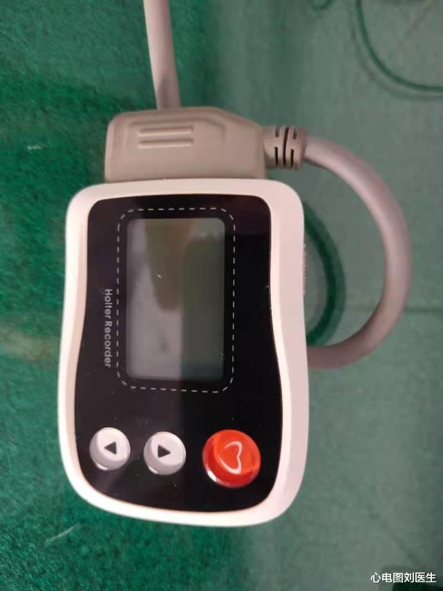 心电图刘医生|医院简直就是暴利买卖！患者做检查吐槽的对不对？