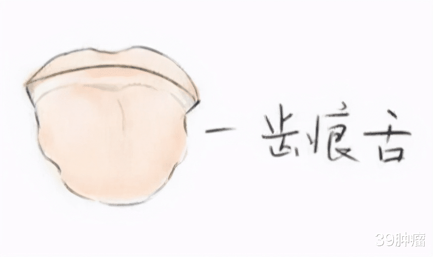 脾胃|头部有5个表现，是湿气重的人，平常多按这两处，湿气越来越少