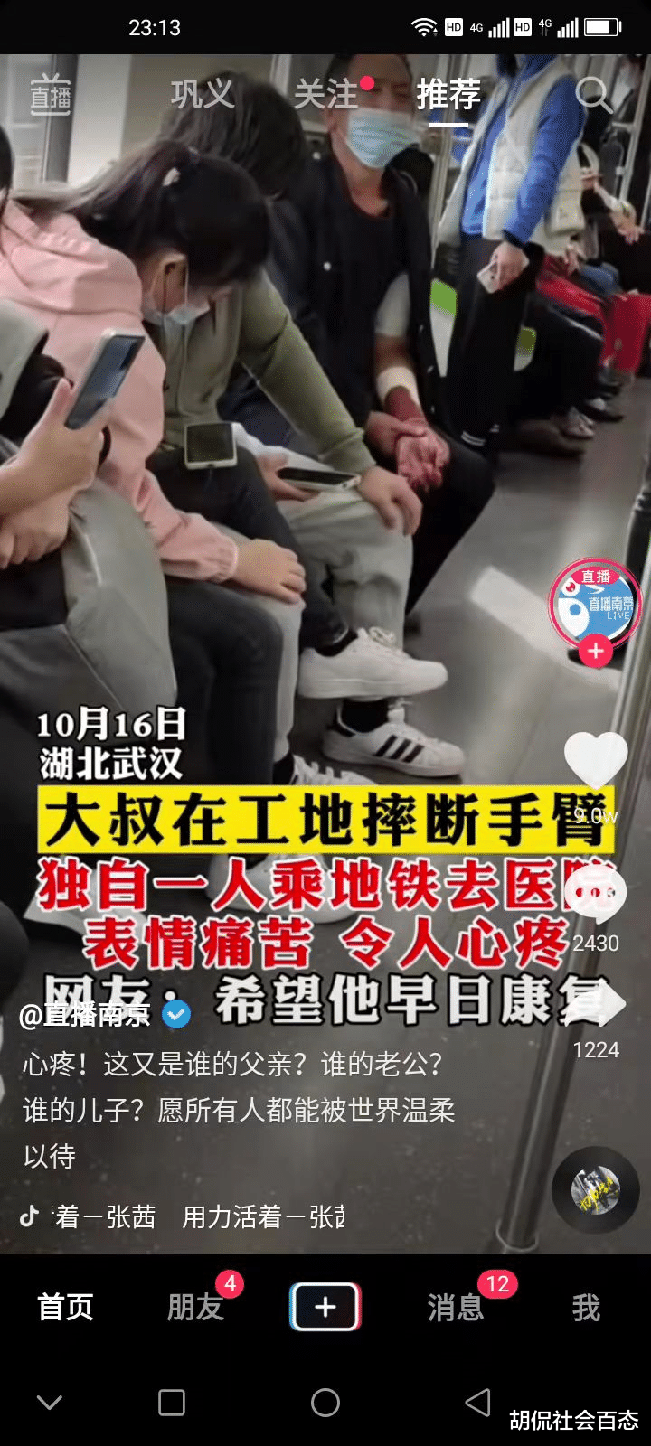 大叔在工地上摔断胳膊,独自忍受剧痛去医院治疗,看哭网友