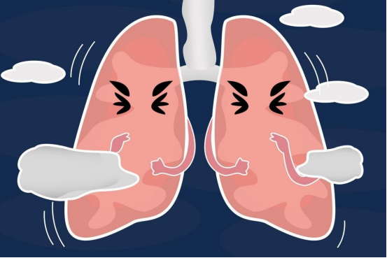 天天听健康|53岁阿姨，做饭三年，确诊肺癌，医生：肺部早已“破烂不堪”