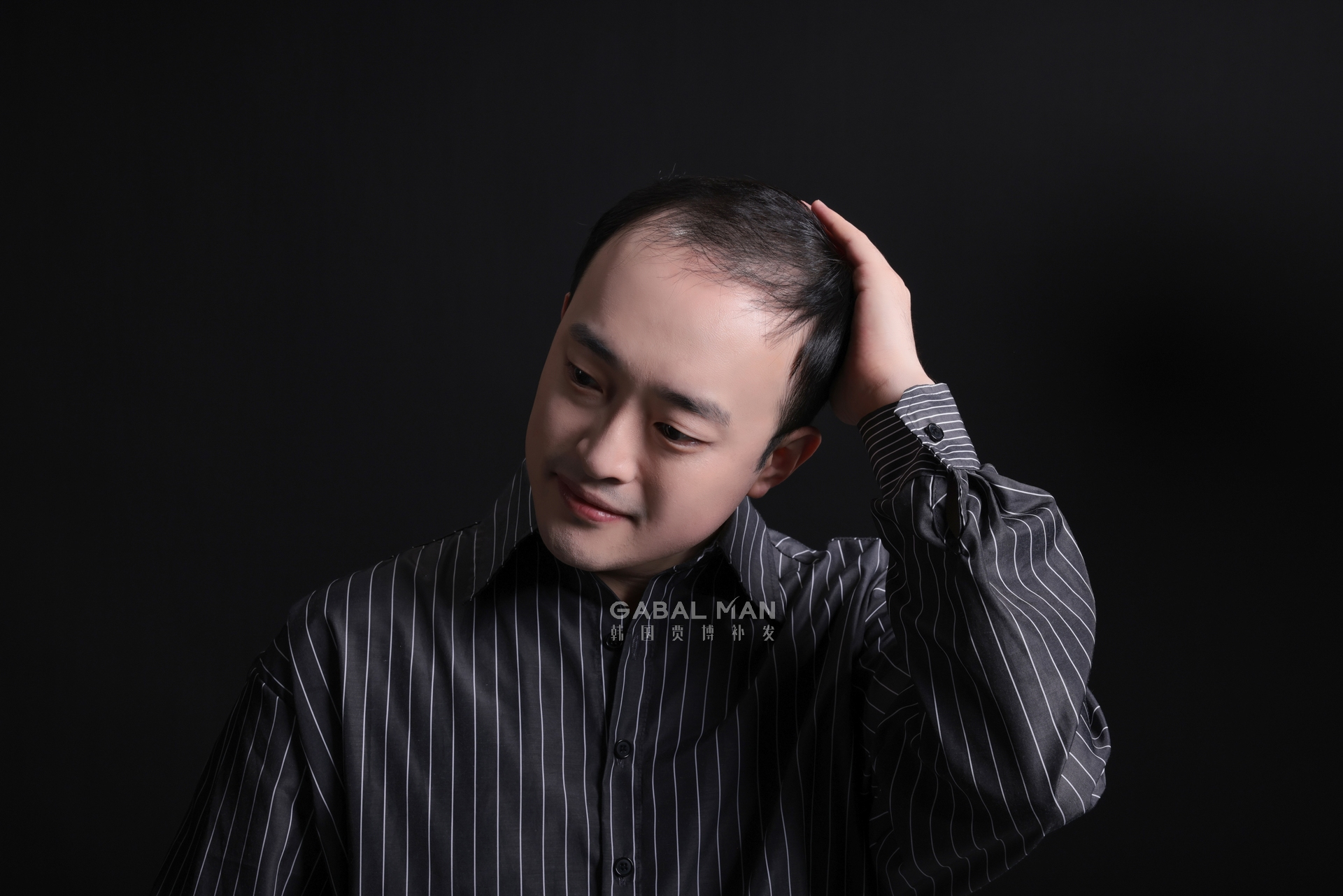 GabalMan贾博补发|发际线过高，怎样拯救？这5个方法要收好