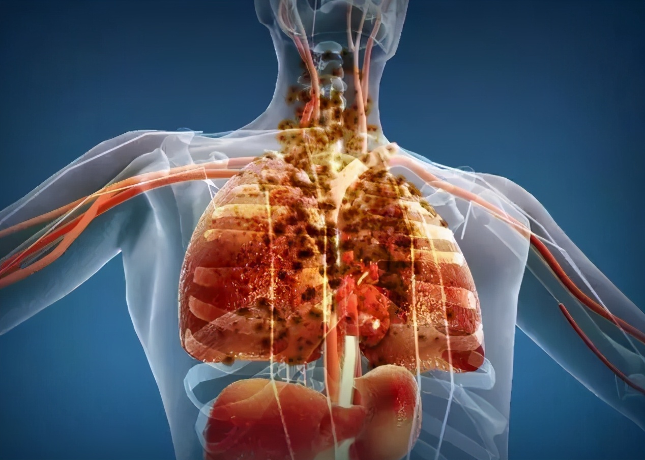 戒烟|长期吸烟的人,点烟前牢记3个字,不用戒烟,也能让肺舒服一些