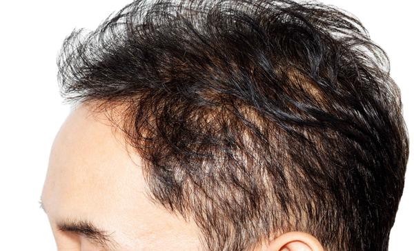 医说健康|衰老来临前，身体会有6种表现，若不想衰老的过快，及时调理