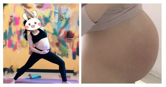 卓卓and然然|“孕妇长纹十有八九”,孕期出现妊娠纹该咋办?可以试试这几招!