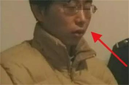 广西 广西一场爱上女同学引发的报复血案