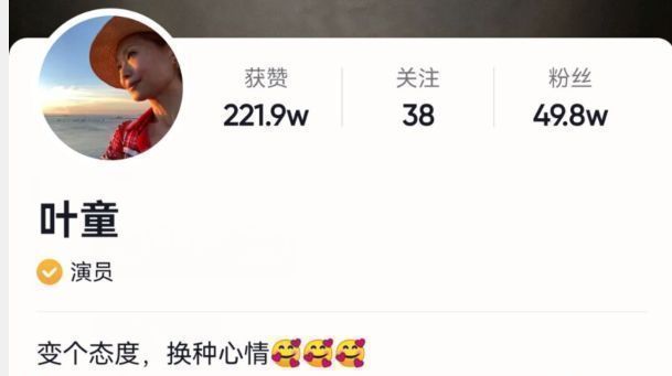 叶童|58岁叶童瘦到认不出？头发凌乱脸颊凹陷，吃路边摊无明星架子