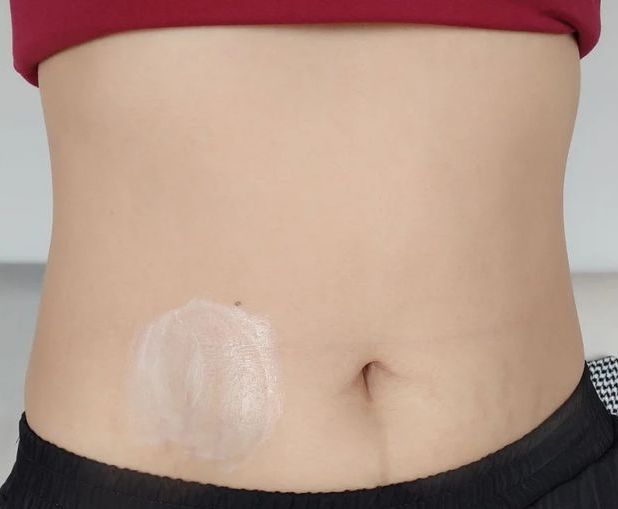 夏小可育儿|孕期防纹四部曲,准妈妈都“达标”,妊娠纹也会远离你的!