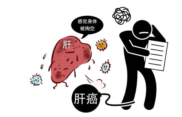 肝癌|你知道吗?肝癌临近时,小便时常有2个特征,若你没有,恭喜你