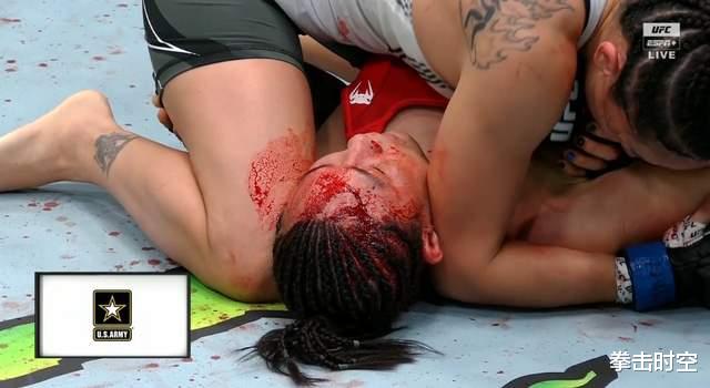 闫晓楠|刚刚，闫晓楠被前UFC冠军KO，挑战罗斯希望破灭，张伟丽机会来了