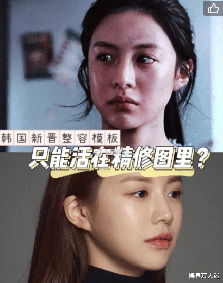 陈钰琪|“韩国第一整容模板”，如今终于脸垮颜值崩，为过度整容付出代价