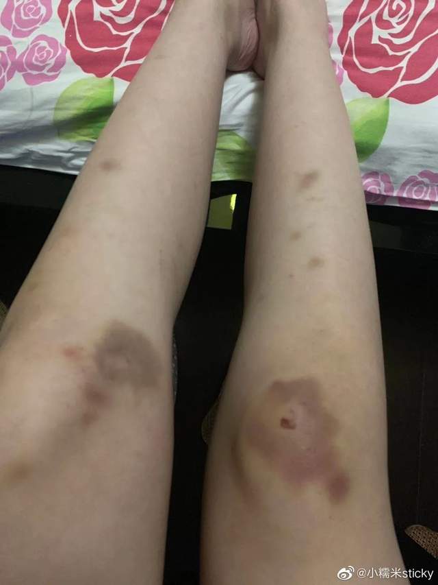 星语星愿吖 LGD教练被曝买菠菜滥赌成性，前妻接连放瓜引热议