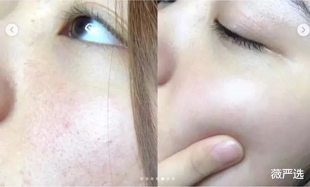 石原里美 变美活教材！石原里美分享十年变美之路，上演现实版丑小鸭变天鹅