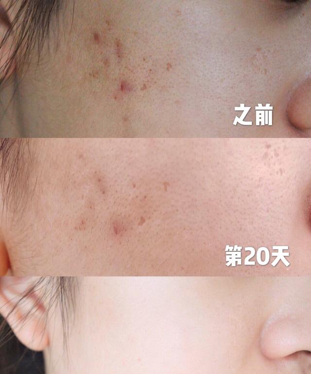 好物官|杨紫张一山同台，衬出杨紫皮肤水嫩如少女，护肤有何秘诀？