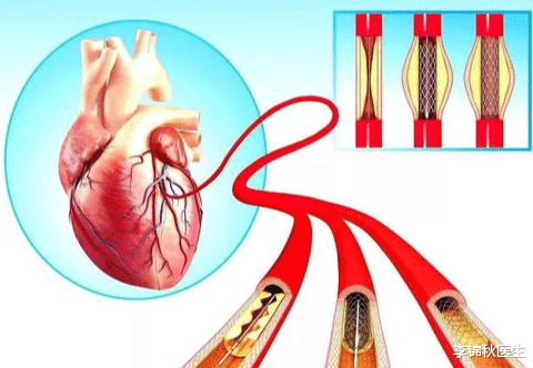 白癜风|体内装有支架,不能做核磁共振检查?医生:超过这个时间就可以