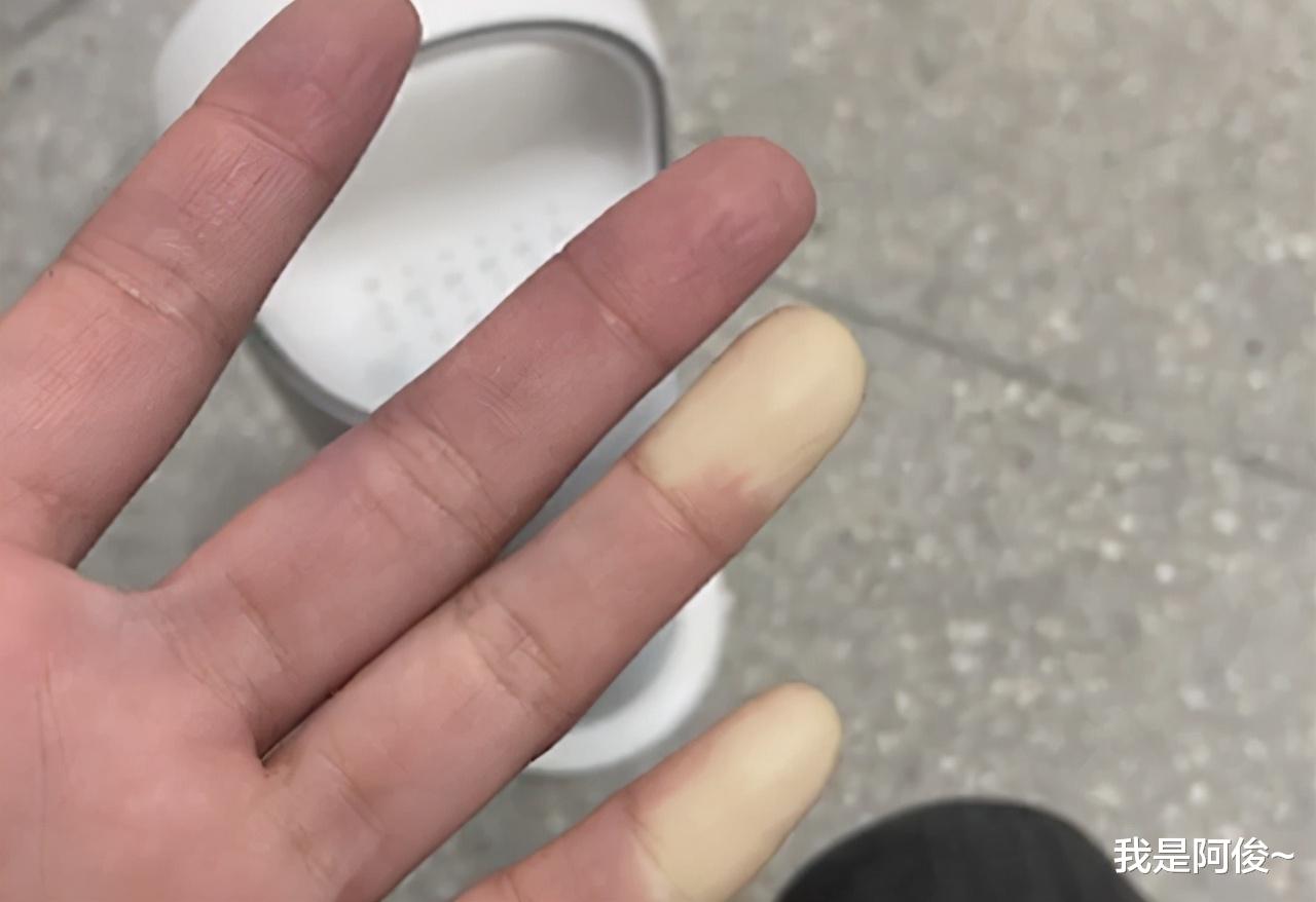 湖南一女子晒冬天手脚冰凉照片,医学生喊话快去医院“这是病”!