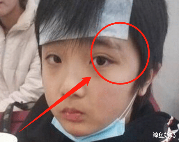 芒果台|他曾为了儿子\手撕\芒果台，如今儿子13岁长成这样伤疤却还在