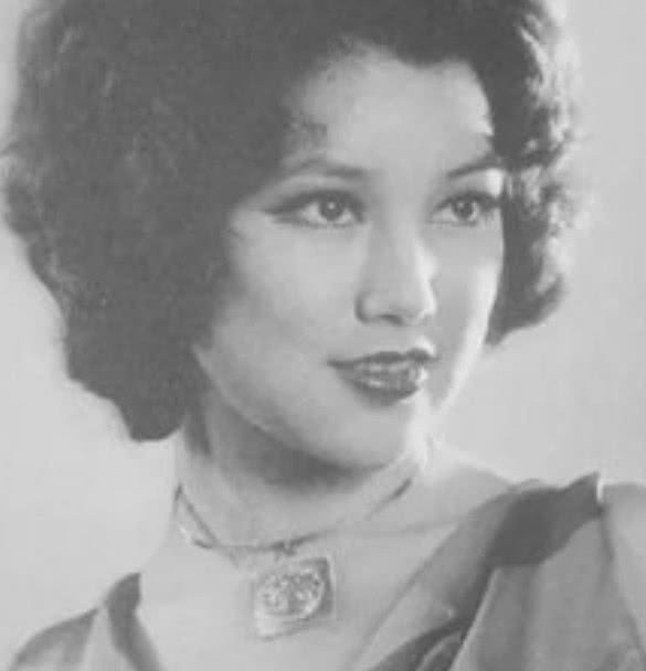 整容|6位整容的女明星曾经有多么美？别人是把自己变美，她们是整残了