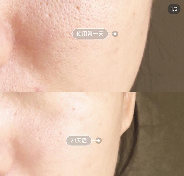 天蝎座|王鸥、张嘉倪公开了抗氧化秘诀:一天一片,21天肌肤光滑透亮