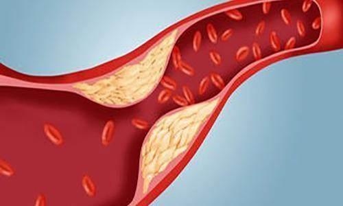 更年期|眼睛出现3个变化，可能是心血管出问题了，把握好4个心脏密码！