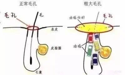 种草的小小苏|把脸打湿,就上洗面奶?做不到“这几点”,别怪毛孔粗大易长痘