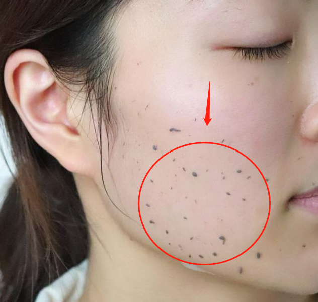 美丽女人的护肤宝典 你若不想被叫“黄脸婆”,多吃1食物,多做3件事,皮肤透亮气色好