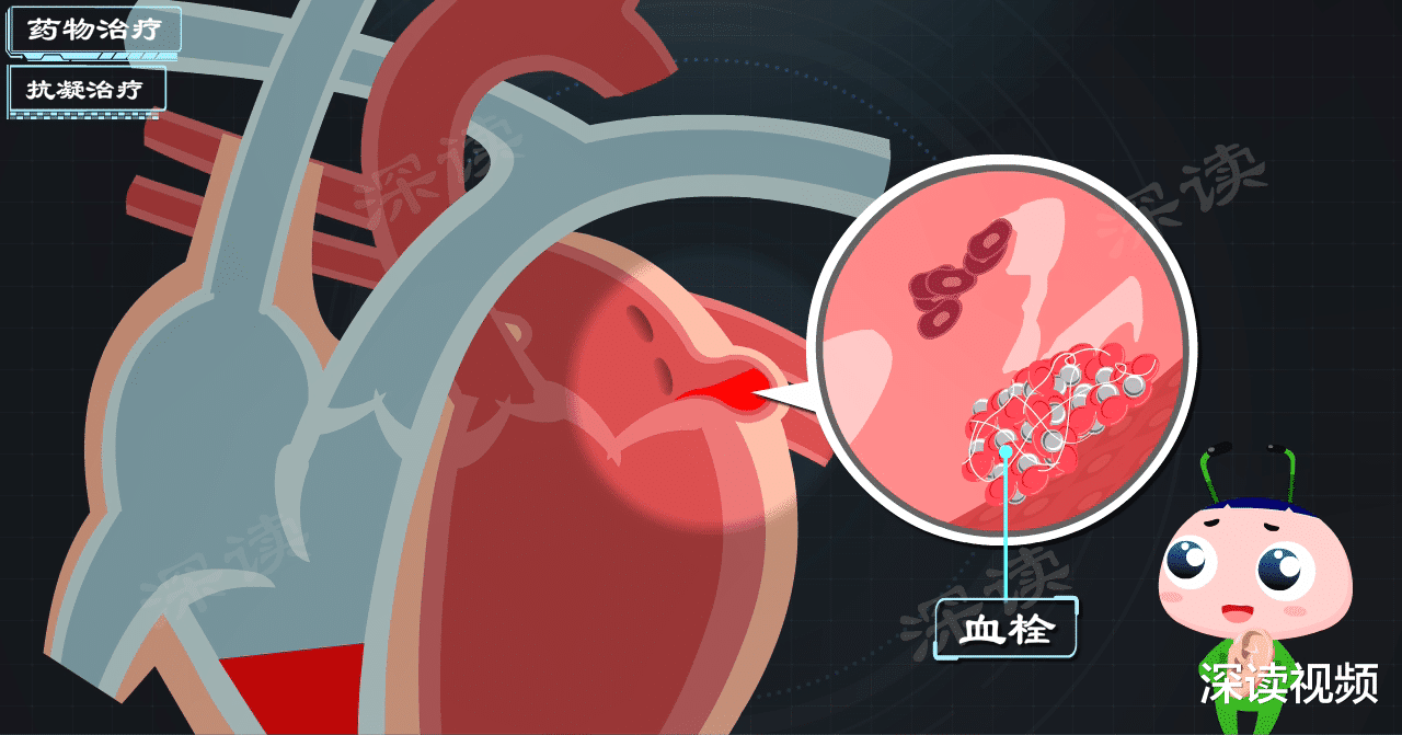 深读视频|这种药既能降血压又能治房颤，房颤治疗又有黑科技，最新！