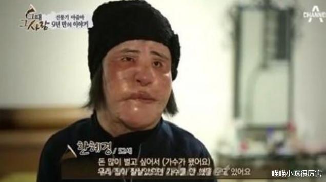 邵音音|年轻时惊为天人,整容后却颜值崩塌,这3位女明星,容貌变化大