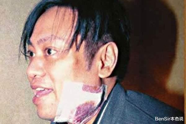 罗兆辉|那一年，刘銮雄派18名保镖送神志不清的罗兆辉返港，其中有何内情？