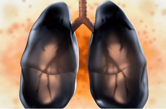 |肺不好，身体或有4种“异常”，一个不占，肺还“干净”