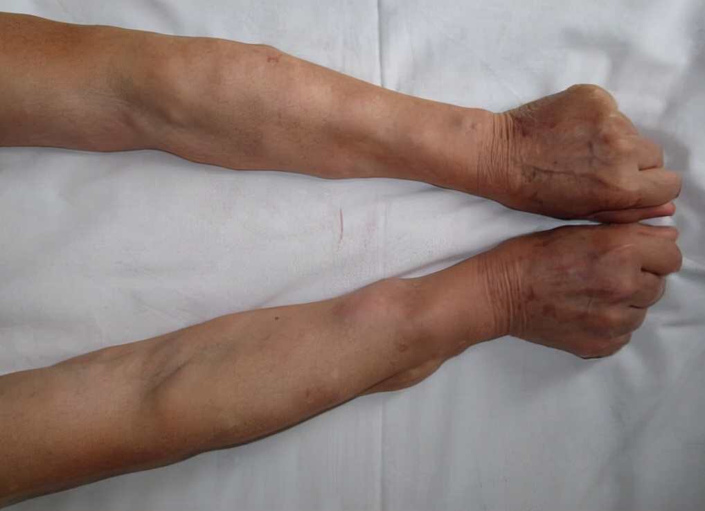 |善治痰者,不治痰而治气,分享4种治气排痰法,气顺痰出