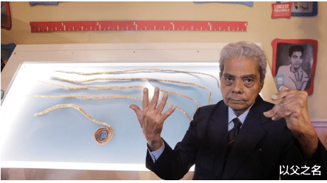印度老頭留瞭44年的指甲，剪掉捐給博物館，手臂卻因此發生新變化-圖4