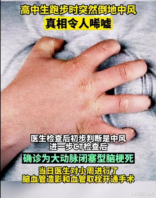 可乐|鬼门关前走了一遭!15岁少年每天1瓶可乐突发脑梗死,医生提醒