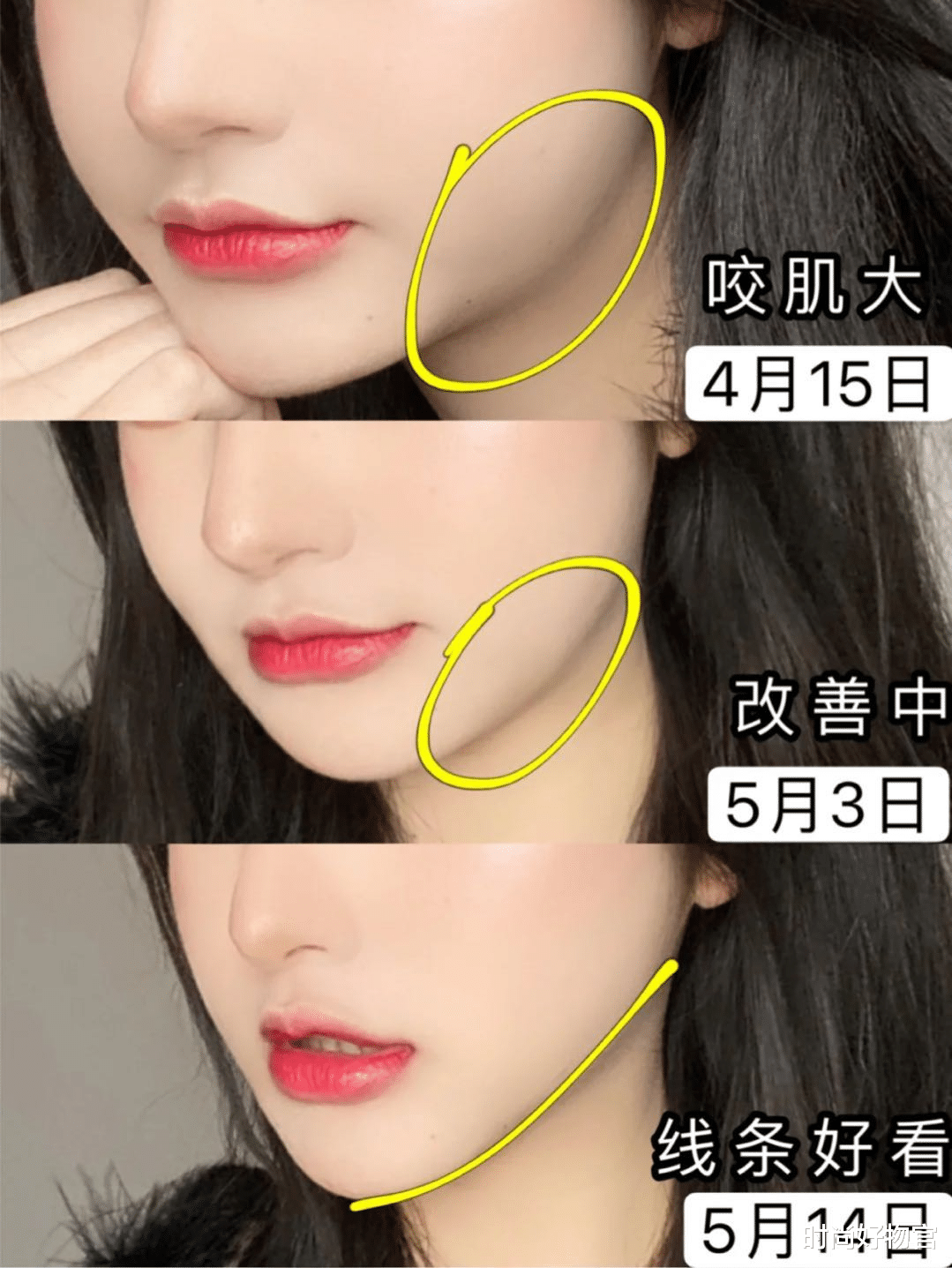 时尚好物官|那些敢于尝试“美容针”的女人，最后怎么样了？过来人说出心里话