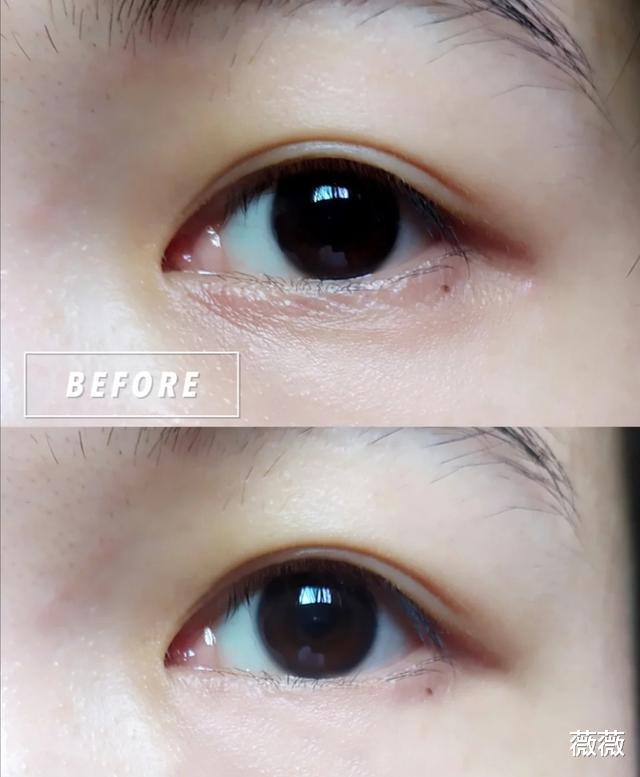 化妆品 戚薇晒自拍照被赞,分享自用“眼霜”,怪不得眼周肌肤紧致细腻!
