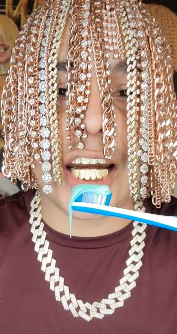 医生|脑门镶钻后，又有歌手钻开头骨植满大金链？网友嘲翻！