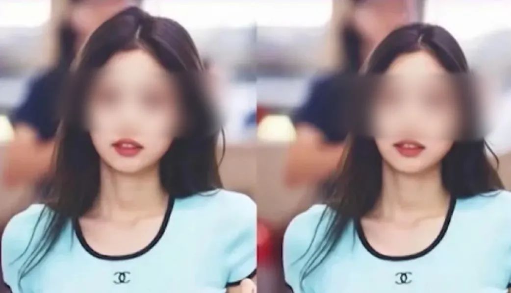 汉方医读 为了变美，真的有人愿意让自己永久残疾。细数那些“畸形”的医美项目。