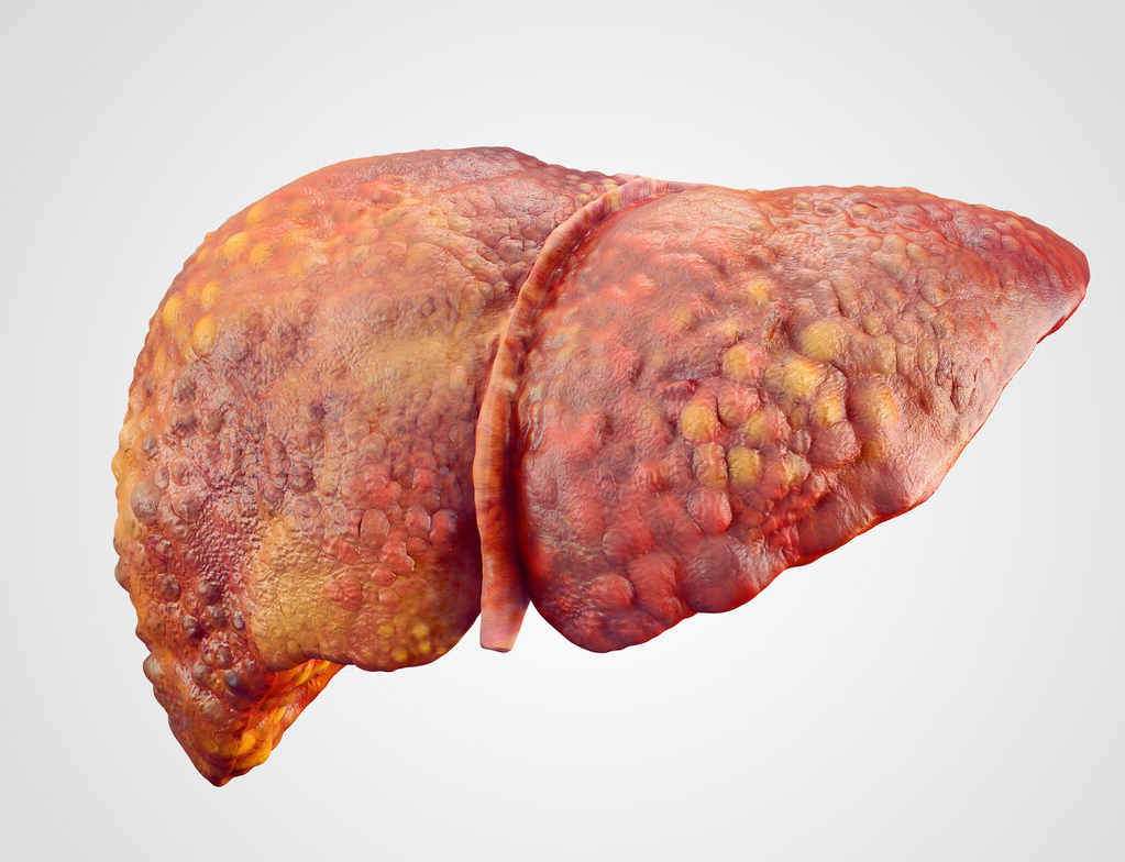 肝脏|上厕所出现3个信号，肝或已“千疮百孔”，若占一个，需好好养肝