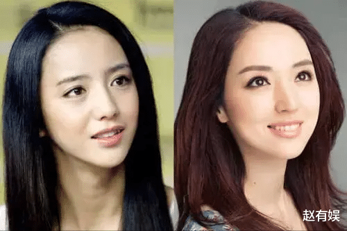 整容|整容脸要结束春天了？为美整容是咎由自取，而他却是无奈之举